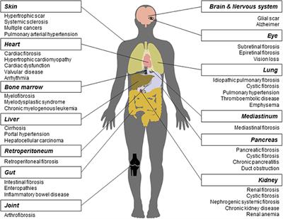 Drugs and Targets in Fibrosis